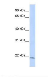 LIN7C / VELI3 Antibody - HepG2 cell lysate. Antibody concentration: 1.0 ug/ml. Gel concentration: 12%.  This image was taken for the unconjugated form of this product. Other forms have not been tested.