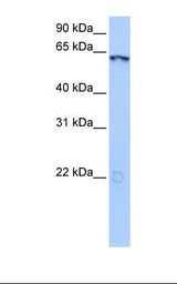LIN9 Antibody - Hela cell lysate. Antibody concentration: 0.5 ug/ml. Gel concentration: 12%.  This image was taken for the unconjugated form of this product. Other forms have not been tested.