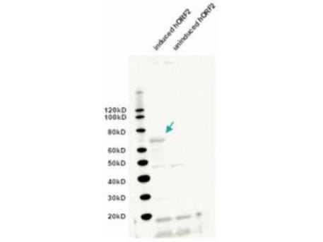 LINE-1 Antibody - Anti-L1/ORF2 Antibody - Western Blot. Western blot of IgY fraction of anti-L1/ORF2 antibody shows detection of induced bacterially expressed human ORF2 (left lane). No specific band staining is seen in the uninduced lane (right lane). The lower molecular weight bands represent non-specific staining. The band at ~70 kD corresponds to a human L1/ORF2 EN domain fusion protein (arrowhead). Personal communication, D. Symer, NCI, Bethesda, MD.