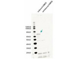 LINE-1 Antibody - Western blot using the IgY fraction of anti-L1/ORF2 antibody shows detection of induced bacterially expressed human ORF2 (left lane). No specific band staining is seen in the uninduced lane (right lane). The lower molecular weight bands represent non-specific staining. The band at ~70 kDa corresponds to a human L1/ORF2 EN domain fusion protein (arrowhead).