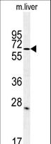 LINGO1 Antibody - Western blot of LINGO-1(LRRN6A)in mouse liver tissue lysates (35 ug/lane). LRRN6A (arrow) was detected using the purified antibody.