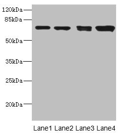 LINGO1 Antibody - Western blot All Lanes: LINGO antibody at 3.12ug/ml Lane 1: Mouse lung tissue Lane 2: Jurkat whole cell lysate Lane 3: A549 whole cell lysate Lane 4: HL60 whole cell lysate Secondary Goat polyclonal to rabbit IgG at 1/10000 dilution Predicted band size: 70 kDa Observed band size: 70 kDa