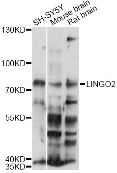 LINGO2 Antibody - Western blot analysis of extracts of various cell lines, using LINGO2 antibody at 1:1000 dilution. The secondary antibody used was an HRP Goat Anti-Rabbit IgG (H+L) at 1:10000 dilution. Lysates were loaded 25ug per lane and 3% nonfat dry milk in TBST was used for blocking. An ECL Kit was used for detection and the exposure time was 60s.