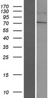LINGO4 Protein - Western validation with an anti-DDK antibody * L: Control HEK293 lysate R: Over-expression lysate