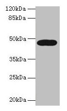 LIPA / Lysosomal Acid Lipase Antibody - Western blot All lanes: LIPA antibody at 10µg/ml + A431 whole cell lysate Secondary Goat polyclonal to rabbit IgG at 1/10000 dilution Predicted band size: 46, 40 kDa Observed band size: 46 kDa