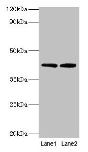 LIPA / Lysosomal Acid Lipase Antibody - Western blot All lanes: Lysosomal acid lipase/cholesteryl ester hydrolase antibody at 2µg/ml Lane 1: MCF-7 whole cell lysate Lane 2: K562 whole cell lysate Secondary Goat polyclonal to rabbit IgG at 1/10000 dilution Predicted band size: 46, 40 kDa Observed band size: 40 kDa