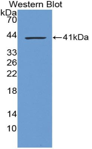 LIPA / Lysosomal Acid Lipase Antibody - Western blot of recombinant LIPA / Lysosomal Acid Lipase.