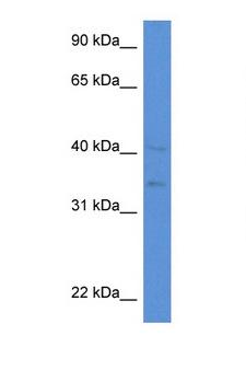 LIPA / Lysosomal Acid Lipase Antibody - LIPA antibody Western blot of HepG2 Cell lysate. Antibody concentration 1 ug/ml.  This image was taken for the unconjugated form of this product. Other forms have not been tested.