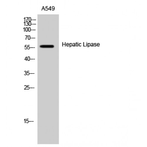 LIPC / Hepatic Lipase Antibody - Western blot of Hepatic Lipase antibody
