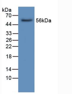 LIPC / Hepatic Lipase Antibody - Western Blot; Sample: Human Liver Tissue.