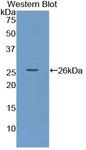 LIPC / Hepatic Lipase Antibody - Western blot of LIPC / Hepatic Lipase antibody.