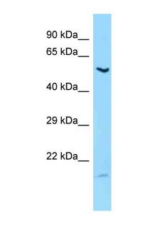 LIPC / Hepatic Lipase Antibody - LIPC antibody Western blot of Fetal Liver lysate. Antibody concentration 1 ug/ml.  This image was taken for the unconjugated form of this product. Other forms have not been tested.