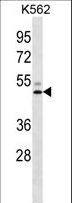 LIPC / Hepatic Lipase Antibody - LIPC Antibody western blot of K562 cell line lysates (35 ug/lane). The LIPC antibody detected the LIPC protein (arrow).