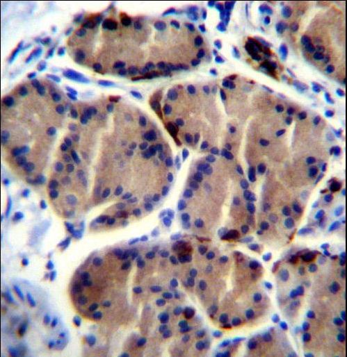 LIPC / Hepatic Lipase Antibody - LIPC Antibody immunohistochemistry of formalin-fixed and paraffin-embedded human stomach tissue followed by peroxidase-conjugated secondary antibody and DAB staining.
