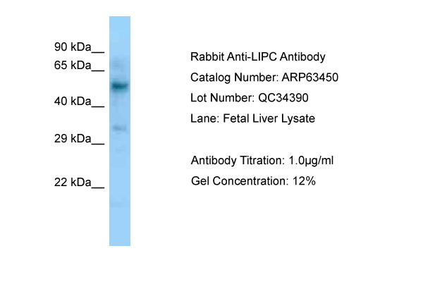 LIPC / Hepatic Lipase Antibody -  This image was taken for the unconjugated form of this product. Other forms have not been tested.
