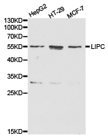 LIPC / Hepatic Lipase Antibody - Western blot of extracts of various cell lines, using LIPC antibody.