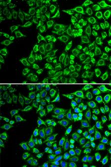 LIPC / Hepatic Lipase Antibody - Immunofluorescence analysis of A549 cells.