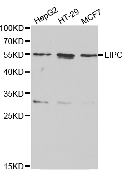 LIPC / Hepatic Lipase Antibody - Western blot analysis of extracts of various cell lines, using LIPC antibody at 1:1000 dilution. The secondary antibody used was an HRP Goat Anti-Rabbit IgG (H+L) at 1:10000 dilution. Lysates were loaded 25ug per lane and 3% nonfat dry milk in TBST was used for blocking.