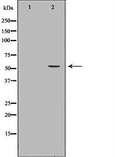 LIPC / Hepatic Lipase Antibody - Western blot analysis of HepG2 whole cells lysates using LIPC antibody. The lane on the left is treated with the antigen-specific peptide.