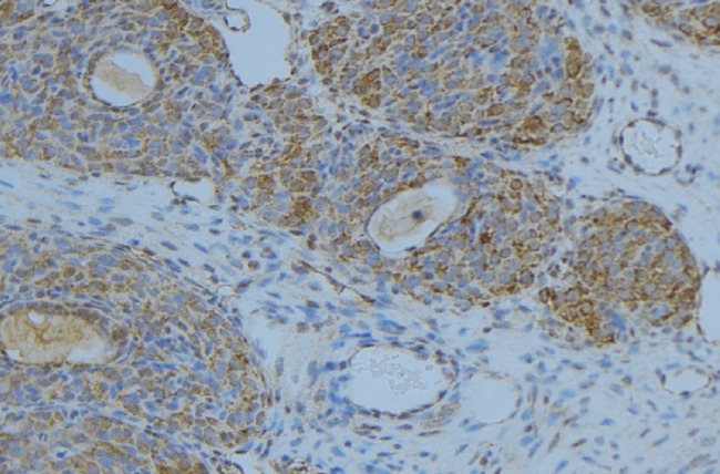 LIPC / Hepatic Lipase Antibody - 1:100 staining human uterus tissue by IHC-P. The sample was formaldehyde fixed and a heat mediated antigen retrieval step in citrate buffer was performed. The sample was then blocked and incubated with the antibody for 1.5 hours at 22°C. An HRP conjugated goat anti-rabbit antibody was used as the secondary.