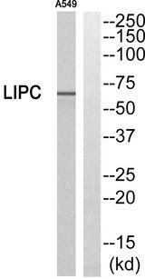 LIPC / Hepatic Lipase Antibody - Western blot analysis of extracts from A549 cells, using LIPC antibody.