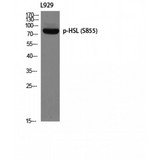 LIPE / HSL Antibody - Western blot of Phospho-HSL (S855) antibody