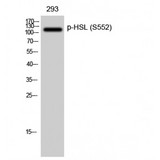 LIPE / HSL Antibody - Western blot of Phospho-HSL (S552) antibody