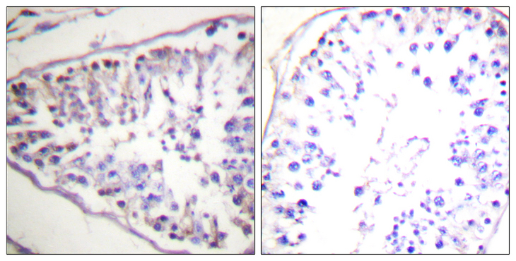 LIPE / HSL Antibody - Immunohistochemistry analysis of paraffin-embedded human tonsil tissue, using HSL Antibody. The picture on the right is blocked with the synthesized peptide.