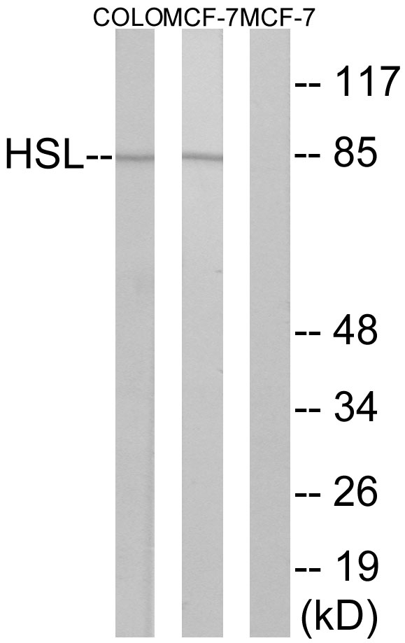 LIPE / HSL Antibody - Western blot analysis of lysates from COLO and MCF7 cells, using HSL Antibody. The lane on the right is blocked with the synthesized peptide.