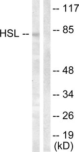 LIPE / HSL Antibody - Western blot analysis of lysates from HeLa cells, treated with Calyculin A 100nM 30', using HSL Antibody. The lane on the right is blocked with the synthesized peptide.