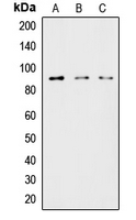 LIPE / HSL Antibody - Western blot analysis of HSL expression in HeLa (A); MCF7 (B); COLO205 (C) whole cell lysates.