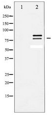 LIPE / HSL Antibody - Western blot of HSL expression in Calyculin A treated HeLa whole cell lysates,The lane on the left is treated with the antigen-specific peptide.