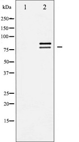 LIPE / HSL Antibody - Western blot analysis of HSL expression in CalyculinA treated HeLa whole cells lysates. The lane on the left is treated with the antigen-specific peptide.