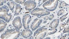 LIPE / HSL Antibody - 1:100 staining human prostate tissue by IHC-P. The sample was formaldehyde fixed and a heat mediated antigen retrieval step in citrate buffer was performed. The sample was then blocked and incubated with the antibody for 1.5 hours at 22°C. An HRP conjugated goat anti-rabbit antibody was used as the secondary.