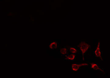 LIPE / HSL Antibody - Staining HeLa cells by IF/ICC. The samples were fixed with PFA and permeabilized in 0.1% Triton X-100, then blocked in 10% serum for 45 min at 25°C. The primary antibody was diluted at 1:200 and incubated with the sample for 1 hour at 37°C. An Alexa Fluor 594 conjugated goat anti-rabbit IgG (H+L) antibody, diluted at 1/600, was used as secondary antibody.