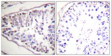 LIPE / HSL Antibody - Peptide - + Immunohistochemistry analysis of paraffin-embedded human tonsil tissue using HSL (Ab-552) antibody.
