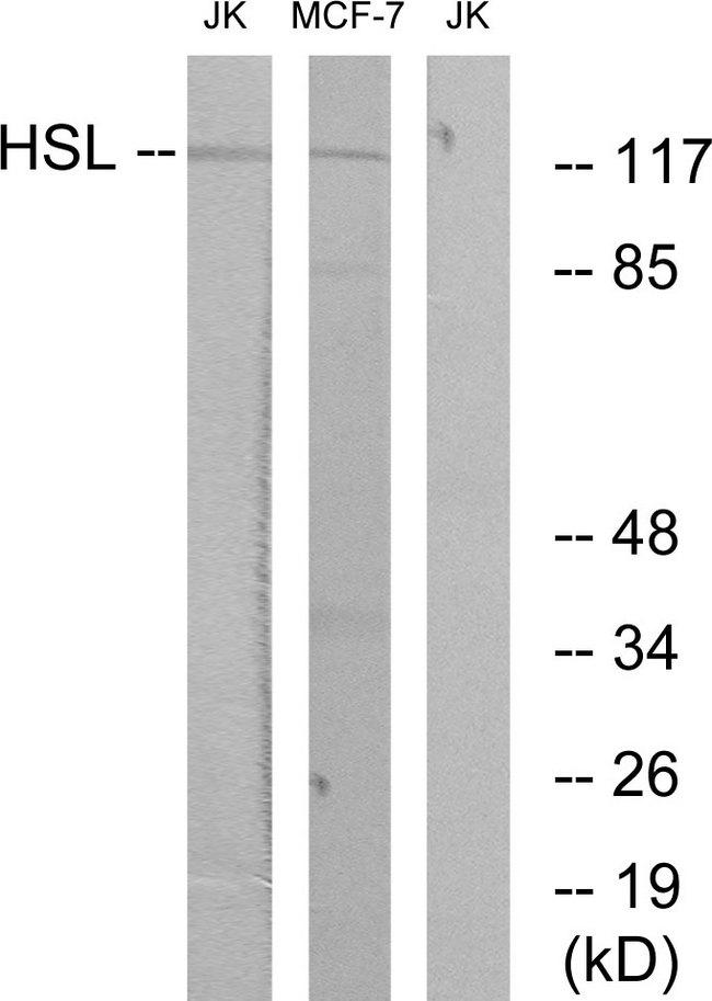 LIPE / HSL Antibody - Western blot analysis of extracts from Jurkat cells and MCF-7 cells, using HSL (Ab-552) antibody.
