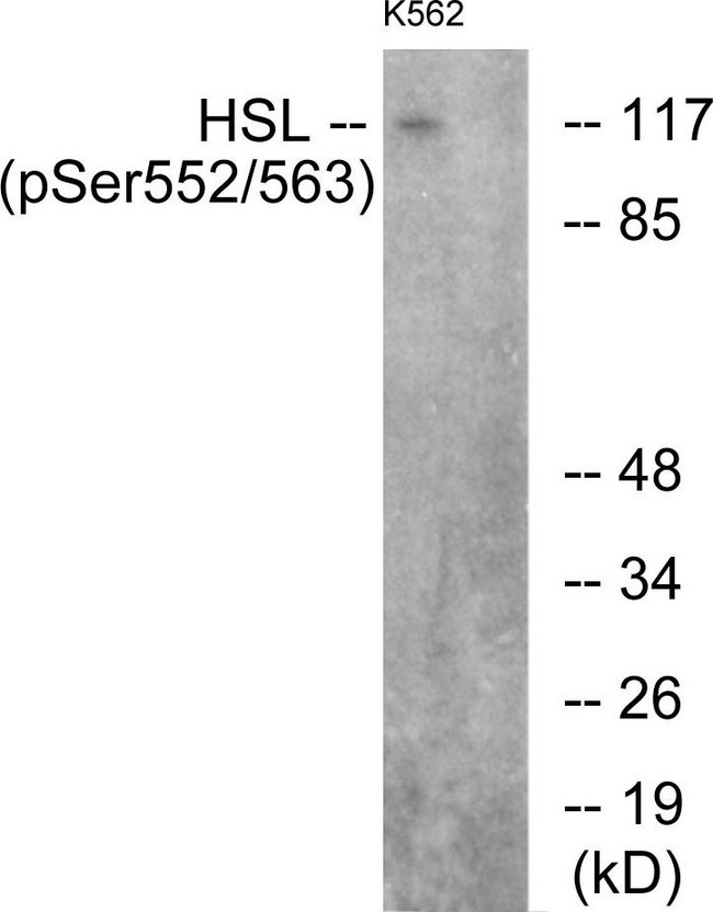 LIPE / HSL Antibody - Western blot analysis of lysates from K562 cells, using HSL (Phospho-Ser552) Antibody. The lane on the right is blocked with the phospho peptide.
