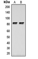 LIPE / HSL Antibody - Western blot analysis of HSL (pS552) expression in HeLa (A); HEK293T (B) whole cell lysates.