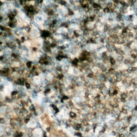 LIPE / HSL Antibody - Immunohistochemical analysis of HSL (pS552) staining in human lymph node formalin fixed paraffin embedded tissue section. The section was pre-treated using heat mediated antigen retrieval with sodium citrate buffer (pH 6.0). The section was then incubated with the antibody at room temperature and detected using an HRP conjugated compact polymer system. DAB was used as the chromogen. The section was then counterstained with hematoxylin and mounted with DPX.
