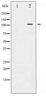LIPE / HSL Antibody - Western blot of HSL phosphorylation expression in K562 whole cell lysates,The lane on the left is treated with the antigen-specific peptide.