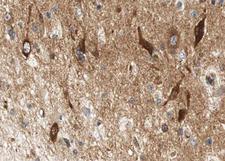 LIPE / HSL Antibody - 1:100 staining human brain tissue by IHC-P. The tissue was formaldehyde fixed and a heat mediated antigen retrieval step in citrate buffer was performed. The tissue was then blocked and incubated with the antibody for 1.5 hours at 22°C. An HRP conjugated goat anti-rabbit antibody was used as the secondary.