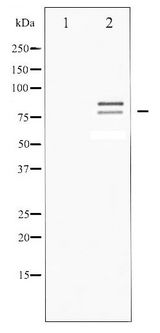 LIPE / HSL Antibody - Western blot of HSL phosphorylation expression in Adriamycin treated HeLa whole cell lysates,The lane on the left is treated with the antigen-specific peptide.
