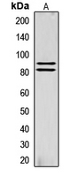LIPE / HSL Antibody - Western blot analysis of HSL (pS855) expression in Human muscle (A) whole cell lysates.