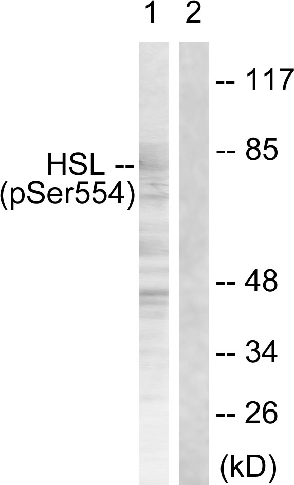 LIPE / HSL Antibody - Western blot analysis of lysates from HeLa cells treated with Adriamycin 0.5ng/ml 24h, using HSL (Phospho-Ser855/554) Antibody. The lane on the right is blocked with the phospho peptide.