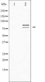 LIPE / HSL Antibody - Western blot analysis of HSL phosphorylation expression in Adriamyci treated HeLa whole cells lysates. The lane on the left is treated with the antigen-specific peptide.