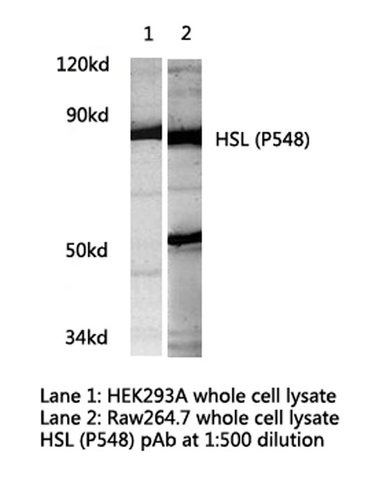 LIPE / HSL Antibody - Western blot of HSL (P548) pAb in extracts from HEK293 and Raw264.7 cells.