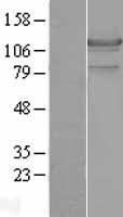 LIPE / HSL Protein - Western validation with an anti-DDK antibody * L: Control HEK293 lysate R: Over-expression lysate
