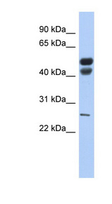 LIPF / GL / Gastric Lipase Antibody - LIPF / Gastric Lipase antibody Western blot of Fetal Stomach lysate. This image was taken for the unconjugated form of this product. Other forms have not been tested.