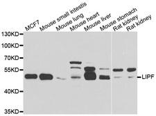 LIPF / GL / Gastric Lipase Antibody - Western blot analysis of extracts of various cell lines.